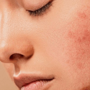 Dermatologia Estetica