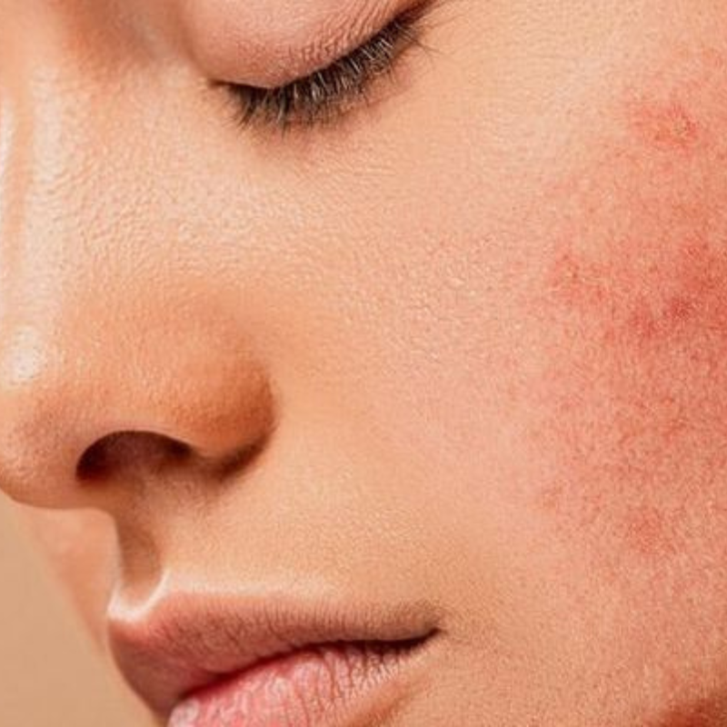 Dermatologia Estetica